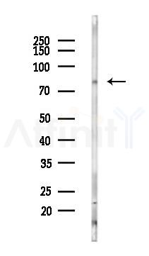 PTCD1 Antibody - Western blot analysis of lysates from Mouse testis, using PTCD1 Antibody at 1/1000 dilution.