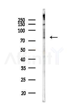PTCD1 Antibody - Western blot analysis of lysates from HepG2 cells(LPS,4h treatment), using PTCD1 Antibody at 1/1000 dilution.