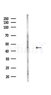 PHF24 Antibody - Western blot analysis of lysates from Hela cells(heat-shock,45min treatment), using PHF24 Antibody at 1/1000 dilution.