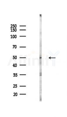 PHF24 Antibody - Western blot analysis of lysates from COLO205 cells(heat-shock,45min treatment), using PHF24 Antibody at 1/1000 dilution.