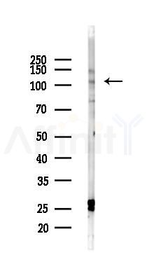 KIAA0753 Antibody - Western blot analysis of lysates from Mouse testis, using KIAA0753 Antibody at 1/1000 dilution.