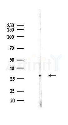 LMCD1 Antibody - Western blot analysis of lysates from COLO205 cells(heat-shock,45min treatment), using LMCD1 Antibody at 1/1000 dilution.
