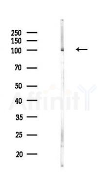 TAX1BP1 Antibody - Western blot analysis of lysates from Hela cells(heat-shock,45min treatment), using TAX1BP1 Antibody at 1/1000 dilution.