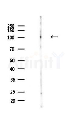 TAX1BP1 Antibody - Western blot analysis of lysates from COLO205 cells(heat-shock,45min treatment), using TAX1BP1 Antibody at 1/1000 dilution.