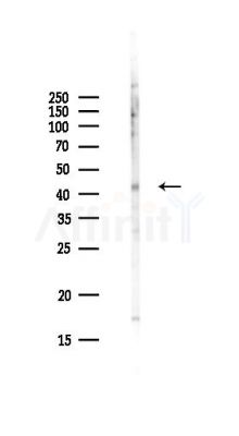 PCMTD1 Antibody - Western blot analysis of lysates from Hela cells(UV,30min treatment), using PCMTD1 Antibody at 1/1000 dilution.