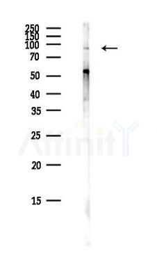 TRMT1L Antibody - Western blot analysis of lysates from COLO205 cells(heat-shock,45min treatment), using TRMT1L Antibody at 1/1000 dilution.