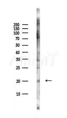 HINT3 Antibody - Western blot analysis of lysates from Hela cells(UV,30min treatment), using HINT3 Antibody at 1/1000 dilution.