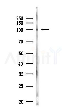 CEP85L Antibody - Western blot analysis of lysates from COLO205 cells(heat-shock,45min treatment), using CEP85L Antibody at 1/1000 dilution.