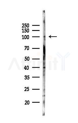 CEP85L Antibody - Western blot analysis of lysates from A375 cells(heat-shock,45min treatment), using CEP85L Antibody at 1/1000 dilution.