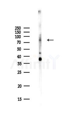 FGD2 Antibody - Western blot analysis of lysates from Hela cells(UV,30min treatment), using FGD2 Antibody at 1/1000 dilution.