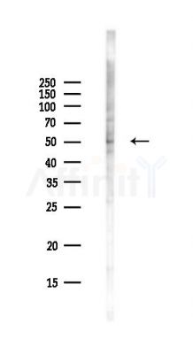 LCHN Antibody - Western blot analysis of lysates from Hela cells(UV,30min treatment), using LCHN Antibody at 1/1000 dilution.