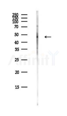 LCHN Antibody - Western blot analysis of lysates from COLO205 cells(heat-shock,45min treatment), using LCHN Antibody at 1/1000 dilution.