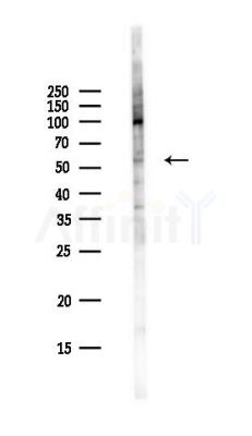 LTV1 Antibody - Western blot analysis of lysates from Hela cells(UV,30min treatment), using LTV1 Antibody at 1/1000 dilution.