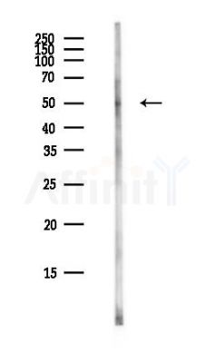 LTV1 Antibody - Western blot analysis of lysates from COLO205 cells(heat-shock,45min treatment), using LTV1 Antibody at 1/1000 dilution.