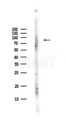 COLGALT2 Antibody - Western blot analysis of lysates from Hela cells(UV,30min treatment), using COLGALT2 Antibody at 1/1000 dilution.