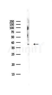 UQCC1 Antibody - Western blot analysis of lysates from Hela cells(UV,30min treatment), using UQCC1 Antibody at 1/1000 dilution.