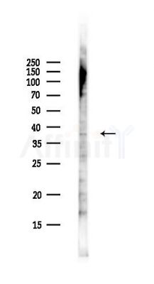 SLC25A43 Antibody - Western blot analysis of lysates from Hela cells(UV,30min treatment), using SLC25A43 Antibody at 1/1000 dilution.