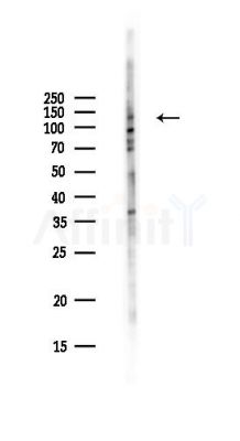 PARD3B Antibody - Western blot analysis of lysates from Hela cells(UV,30min treatment), using PARD3B Antibody at 1/1000 dilution.