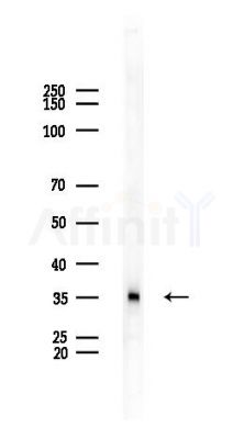 AP1AR Antibody - Western blot analysis of lysates from PC12 cells, using AP1AR Antibody at 1/1000 dilution.