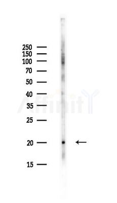 FAM162B Antibody - Western blot analysis of lysates from Hela cells(UV,30min treatment), using FAM162B Antibody at 1/1000 dilution.