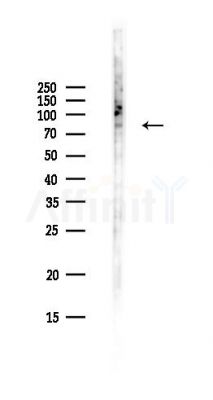 RNF145 Antibody - Western blot analysis of lysates from Hela cells(UV,30min treatment), using RNF145 Antibody at 1/1000 dilution.