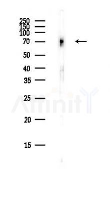 RNF145 Antibody - Western blot analysis of lysates from COLO205 cells(heat-shock,45min treatment), using RNF145 Antibody at 1/1000 dilution.