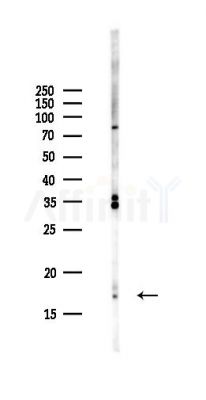 NUDCD2 Antibody - Western blot analysis of lysates from Hela cells(UV,30min treatment), using NUDCD2 Antibody at 1/1000 dilution.
