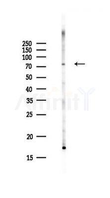 LSG1 Antibody - Western blot analysis of lysates from Hela cells(UV,30min treatment), using LSG1 Antibody at 1/1000 dilution.