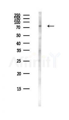 LSG1 Antibody - Western blot analysis of lysates from COLO205 cells(heat-shock,45min treatment), using LSG1 Antibody at 1/1000 dilution.