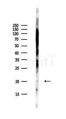 C12orf65 Antibody - Western blot analysis of lysates from Hela cells(UV,30min treatment), using C12orf65 Antibody at 1/1000 dilution.