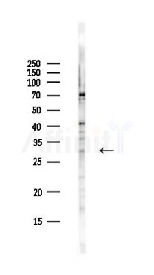 PARM1 Antibody - Western blot analysis of lysates from Hela cells(UV,30min treatment), using PARM1 Antibody at 1/1000 dilution.