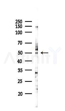 BFSP2 Antibody - Western blot analysis of lysates from A375 cells(heat-shock,45min treatment), using BFSP2 Antibody at 1/1000 dilution.
