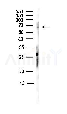 RSPH3 Antibody - Western blot analysis of lysates from MCF7 cells(heat-shock,45min treatment), using RSPH3 Antibody at 1/1000 dilution.