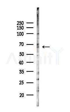 PDE9A Antibody - Western blot analysis of lysates from A375 cells(heat-shock,45min treatment), using PDE9A Antibody at 1/1000 dilution.