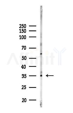 TSFM Antibody - Western blot analysis of lysates from A375 cells(heat-shock,45min treatment), using TSFM Antibody at 1/1000 dilution.