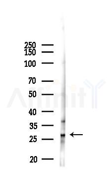 DLX1 Antibody - Western blot analysis of lysates from Mouse liver, using DLX1 Antibody at 1/1000 dilution.