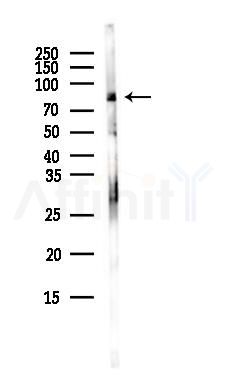 CAPN8 Antibody - Western blot analysis of lysates from COLO205 cells(heat-shock,45min treatment), using CAPN8 Antibody at 1/1000 dilution.