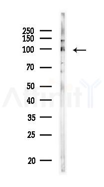 JADE3 Antibody - Western blot analysis of lysates from COLO205 cells(heat-shock,45min treatment), using JADE3 Antibody at 1/1000 dilution.