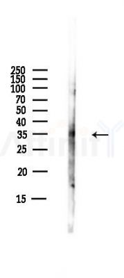 RDH8 Antibody - Western blot analysis of lysates from B16F10-LUC cells(starvation,24h treatment), using RDH8 Antibody at 1/1000 dilution.