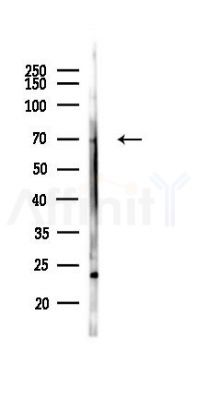 SNX2 Antibody - Western blot analysis of lysates from Mouse liver, using SNX2 Antibody at 1/1000 dilution.