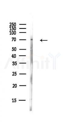 SNX2 Antibody - Western blot analysis of lysates from EC304 cells(heat-shock,45min treatment), using SNX2 Antibody at 1/1000 dilution.