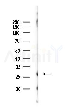 CEMP1 Antibody - Western blot analysis of lysates from MCF7 cells(heat-shock,45min treatment), using CEMP1 Antibody at 1/1000 dilution.