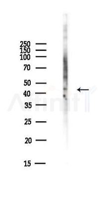 JMJD6 Antibody - Western blot analysis of lysates from EC304 cells(heat-shock,45min treatment), using JMJD6 Antibody at 1/1000 dilution.