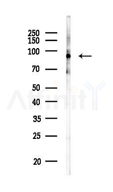PI4KB Antibody - Western blot analysis of lysates from COLO205 cells(heat-shock,45min treatment), using PI4KB Antibody at 1/1000 dilution.