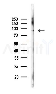 PI4KB Antibody - Western blot analysis of lysates from MCF7 cells(heat-shock,45min treatment), using PI4KB Antibody at 1/1000 dilution.
