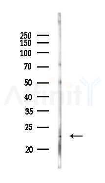 TNNI2 Antibody - Western blot analysis of lysates from Mouse lung, using TNNI2 Antibody at 1/1000 dilution.