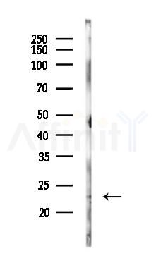 TNNI2 Antibody - Western blot analysis of lysates from Rat liver, using TNNI2 Antibody at 1/1000 dilution.