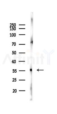 LIMS2 Antibody - Western blot analysis of lysates from Mouse liver, using LIMS2 Antibody at 1/1000 dilution.