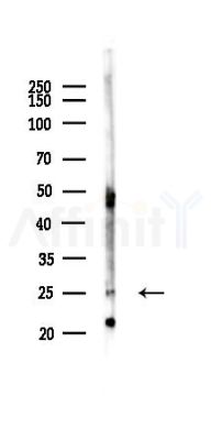 EBP Antibody - Western blot analysis of lysates from Mouse liver, using EBP Antibody at 1/1000 dilution.