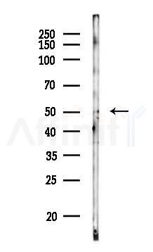 PACSIN1 Antibody - Western blot analysis of lysates from COLO205 cells(heat-shock,45min treatment), using PACSIN1 Antibody at 1/1000 dilution.